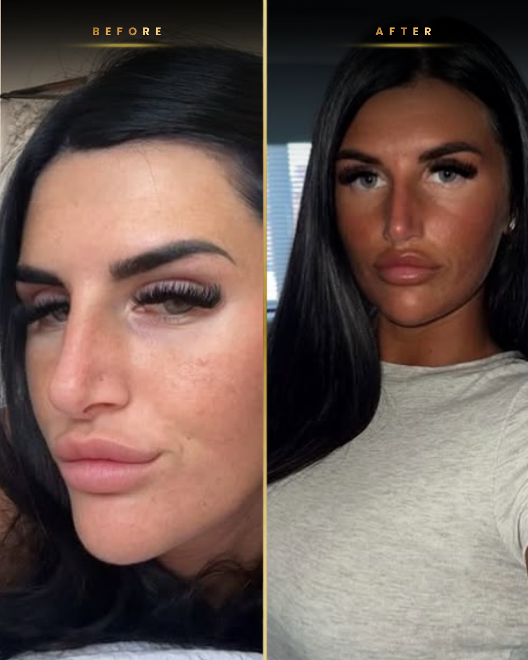 NXT Tanners before and after result 1